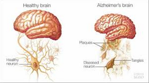 Curcumin from Turmeric improves both memory and mood according to a recent UCLA study